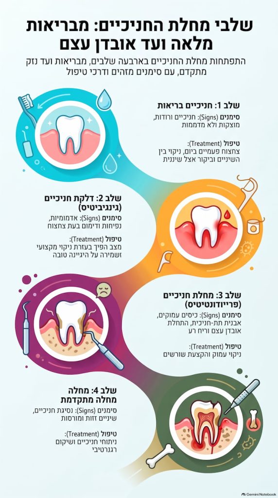 שלבי מחלת החניכיים – מדלקת חניכיים ועד אובדן עצם